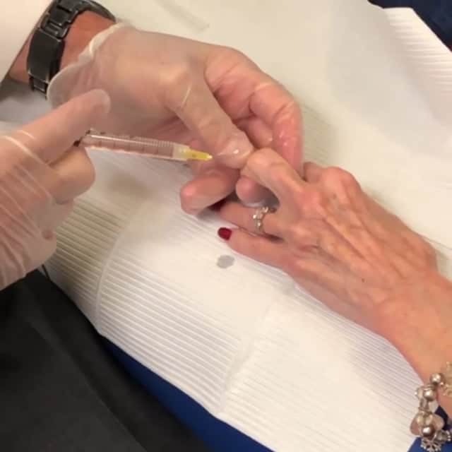 Finger Injections